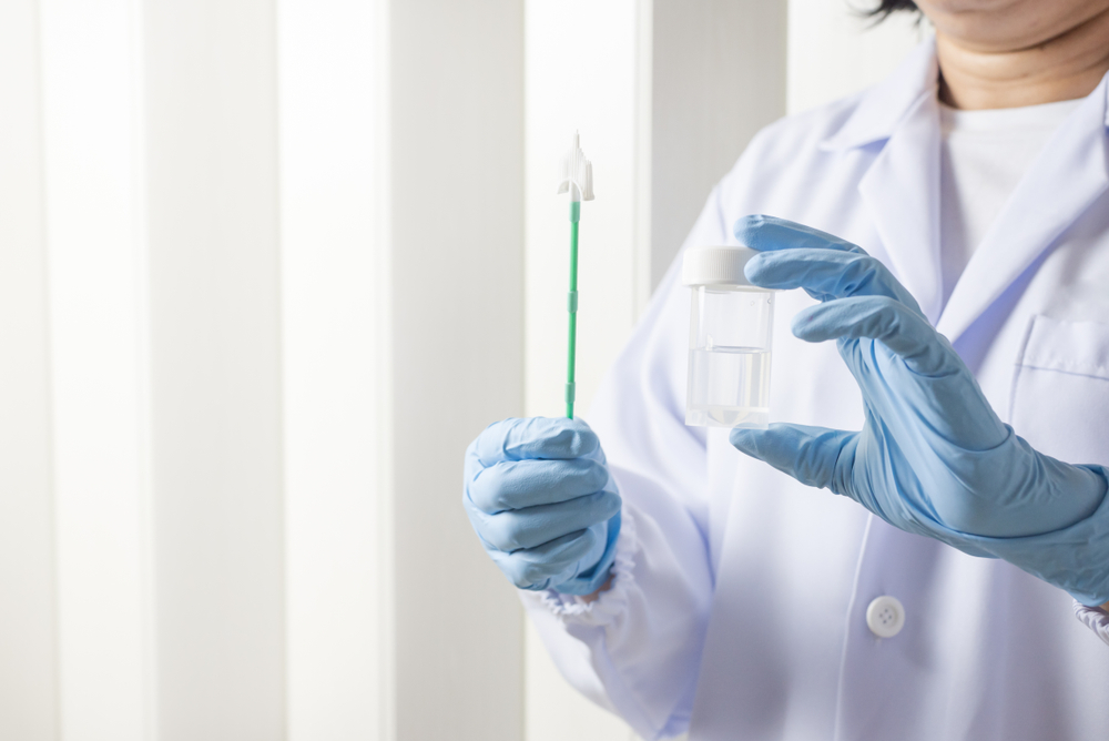 Besmax@CMH Cancerul de col uterin 4 - Cancerul de col uterin - cauze, diagnostic, tratament, preventie