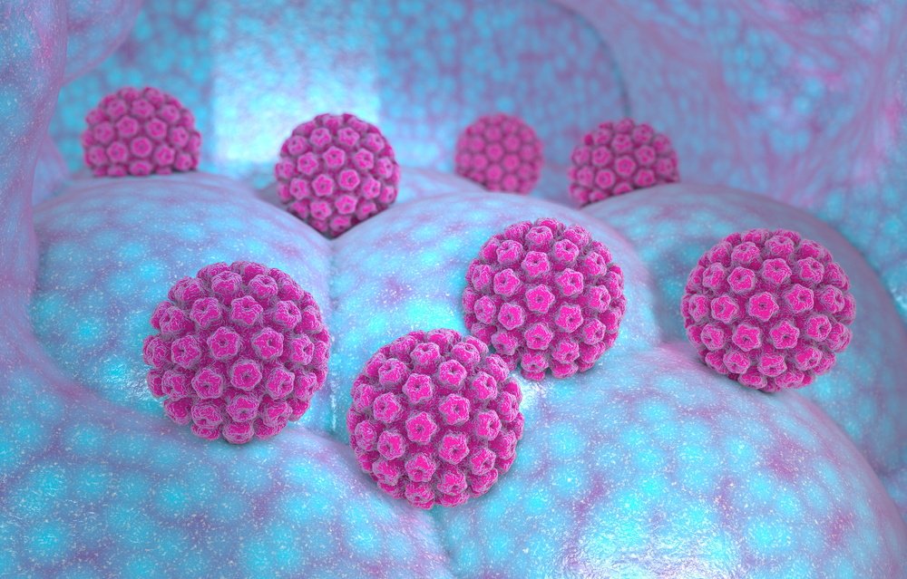 Besmax@CMH Infectia cu HPV 2 - Infectia cu HPV - transmitere, simptome, tratament
